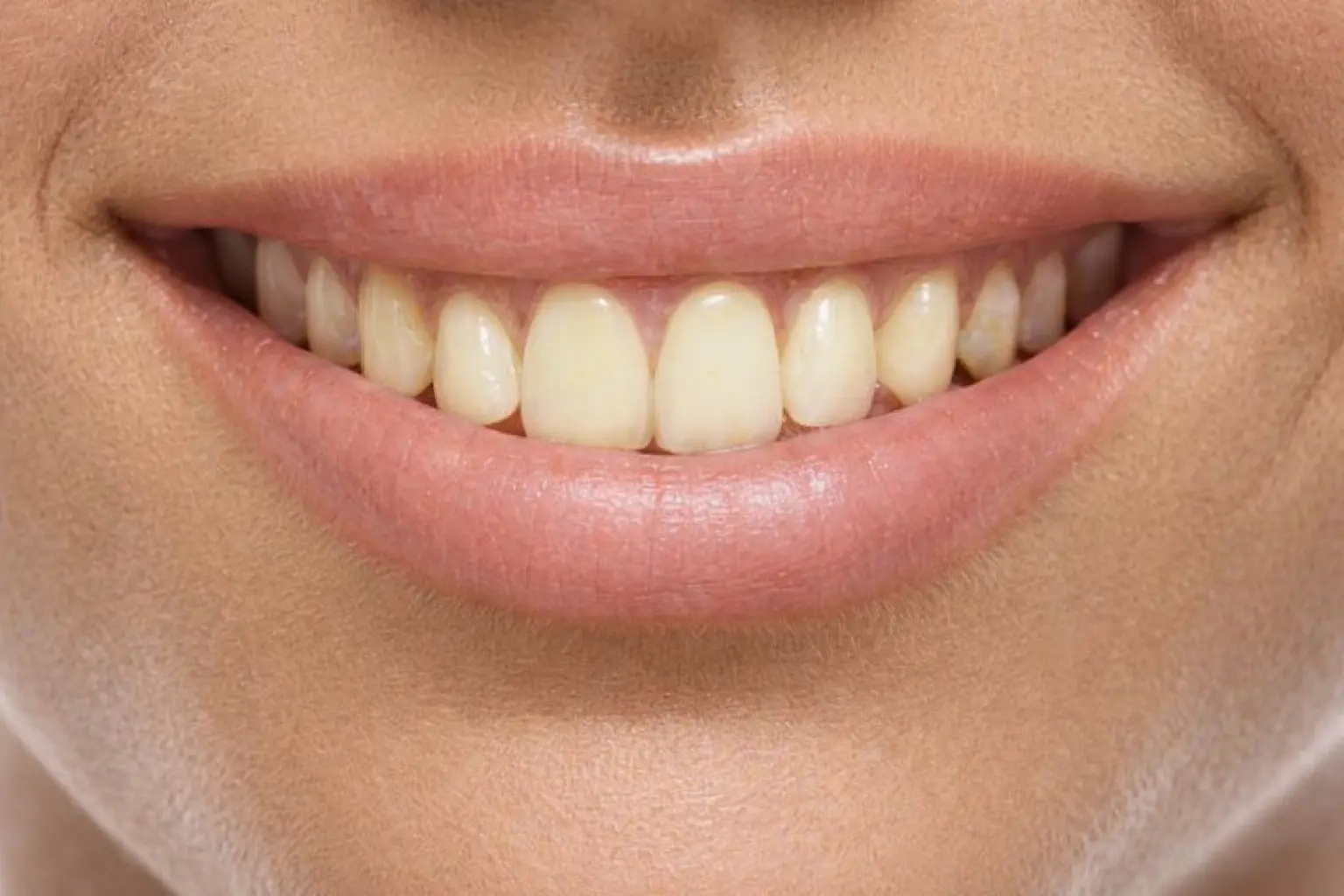 Před ošetřením – zabarvené zuby